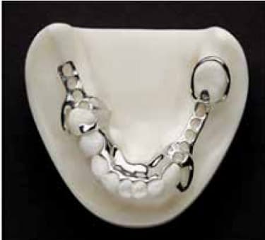 Преимущества и способы применения 3D-печати в медицине и стоматологии